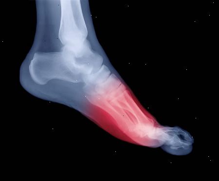 Nogle anatomi af din fod. At have en stiv ankel eller akillessene.