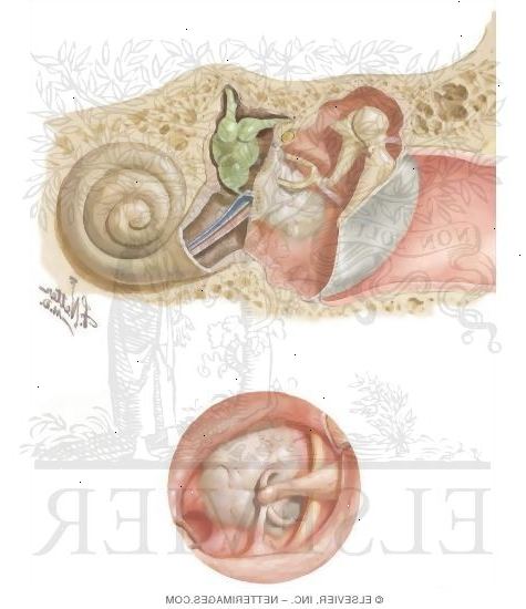 Otosklerose. Hvad er øret ud, og hvordan vi hører?