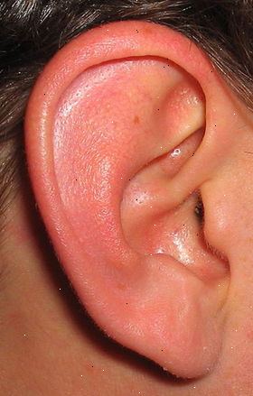 Hvad er symptomerne på lim øre? Udvikling og adfærd kan påvirkes i et lille antal sager.