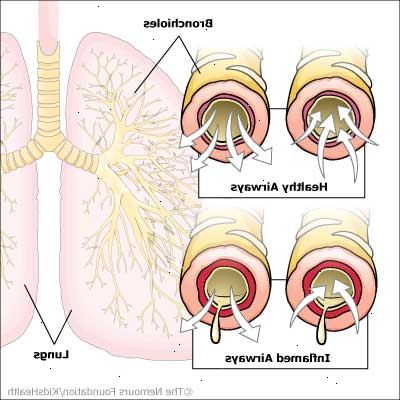 Bronkiolitis. Forståelse lungerne.