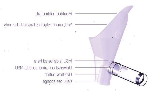 Vadested urinprøve (MSU). For at bekræfte diagnosen en urin infektion.