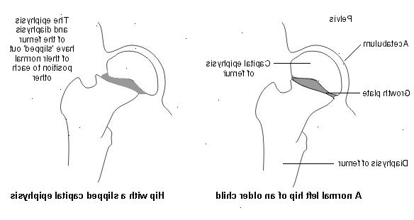 Hofteskred. Nogle anatomi omkring hoften.
