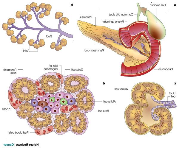 Hvad er kræft i bugspytkirtlen? Ductal adenokarcinom i pancreas.